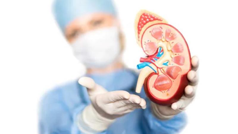 Do's & Don'ts Of Kidney Stone Diet